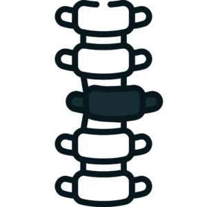 Espondilolistese – Deslizamento vertebral